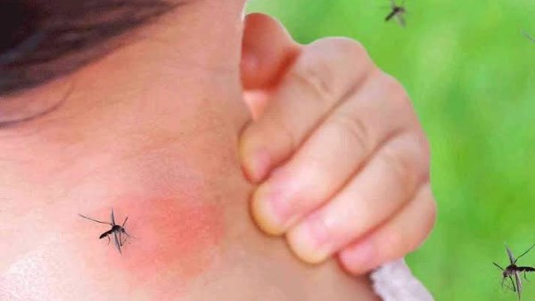 إصابات قياسية.. فلوريدا تعلن الطوارئ الصحية لمواجهة تفشي حمى الضنك
