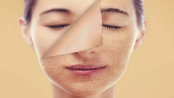 وصفة طبيعية سهلة لتفتيح البشرة في المنزل