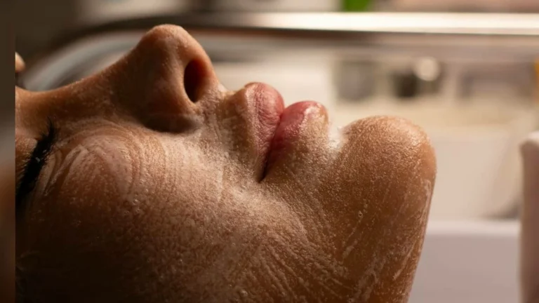 Adult acne is real, but there are ways to treat it. Here’s what to know