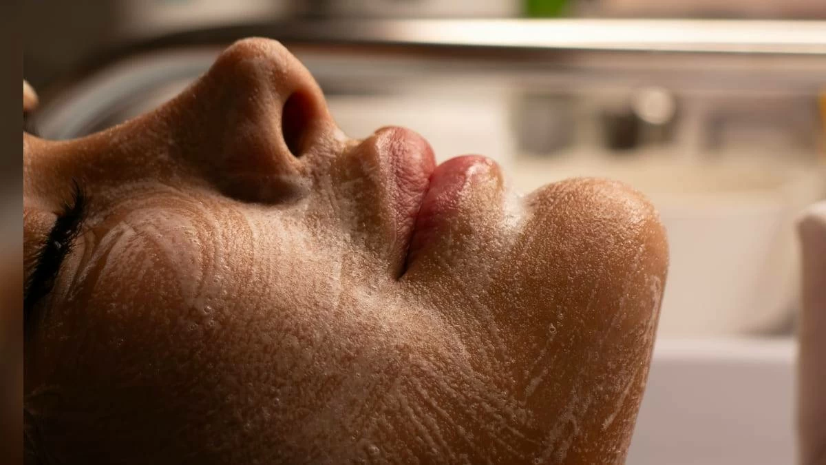 Adult acne is real, but there are ways to treat it. Here’s what to know