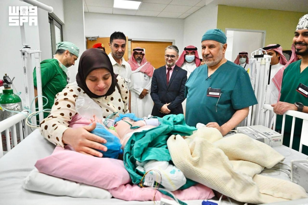 بدء عملية فصل التوأم الملتصق المغربي “سجى وضحى” بالرياض