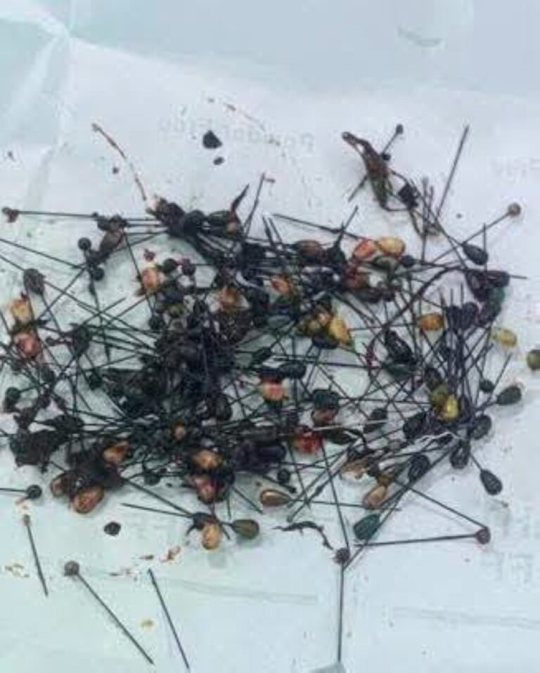 214 إبرة داخل بطن عراقي