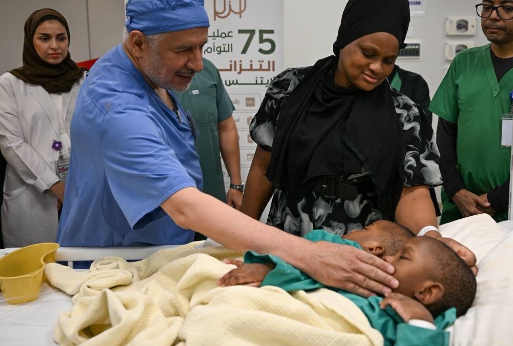 نجاح عملية فصل التوأم السيامي التنزاني بالرياض