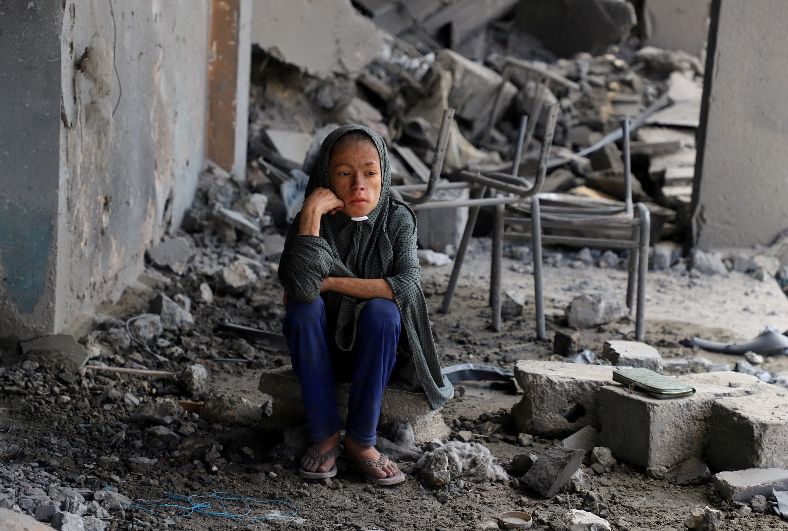 How Gaza’s children are enduring loss and trauma on the war’s third anniversary