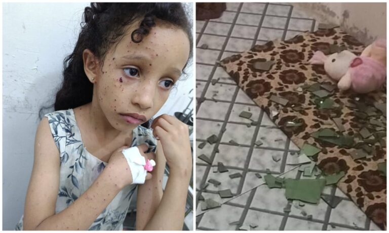 Yemeni minister says young girl injured in Houthi shelling in Taiz