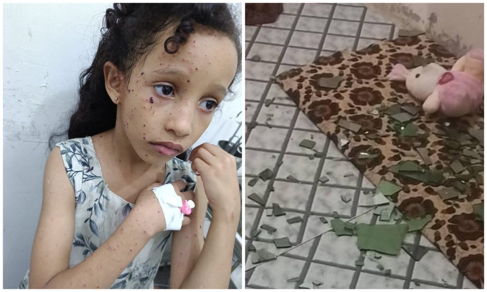 Yemeni minister says young girl injured in Houthi shelling in Taiz