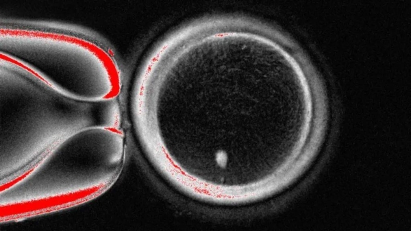 Scientists make embryos from human skin DNA for first time