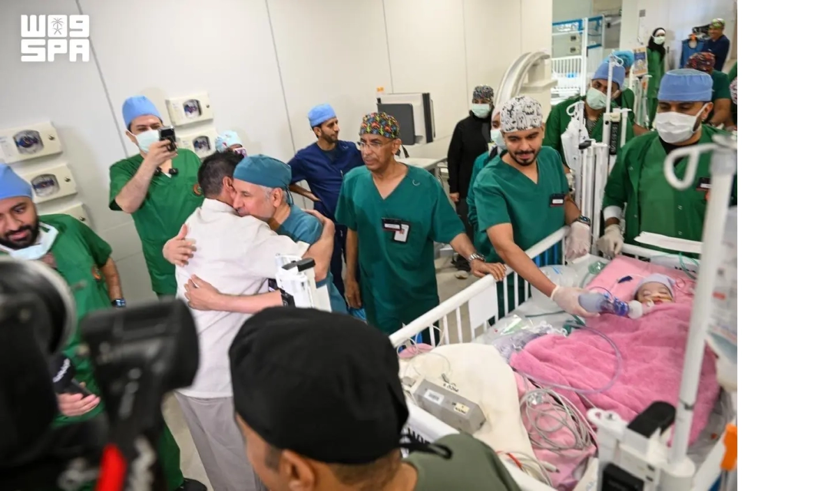 Moroccan conjoined twins separated successfully