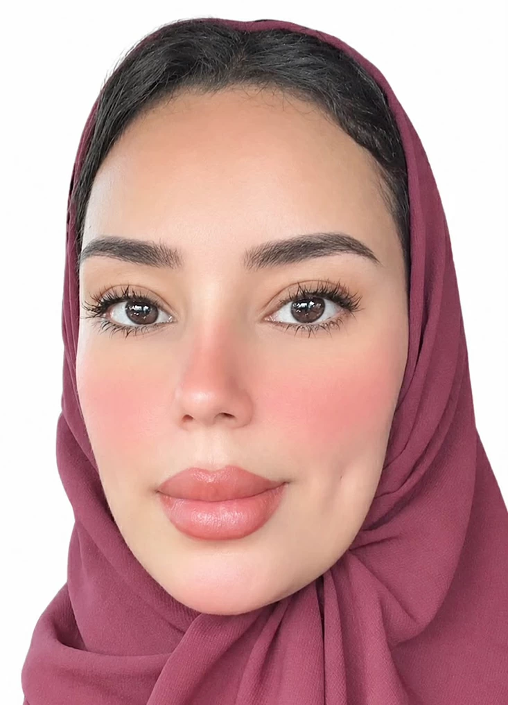 قانونيون وعدليون لـ«عكاظ»: الاعتداءات الحوثية على الأعيان المدنية.. جريمة حرب