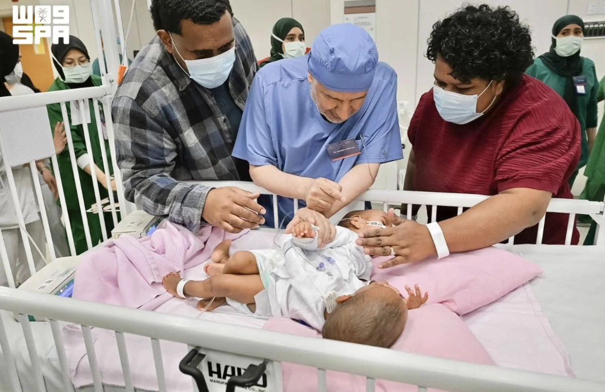 Saudi Arabia begins complex 15-hour surgery to separate Fijian conjoined twins