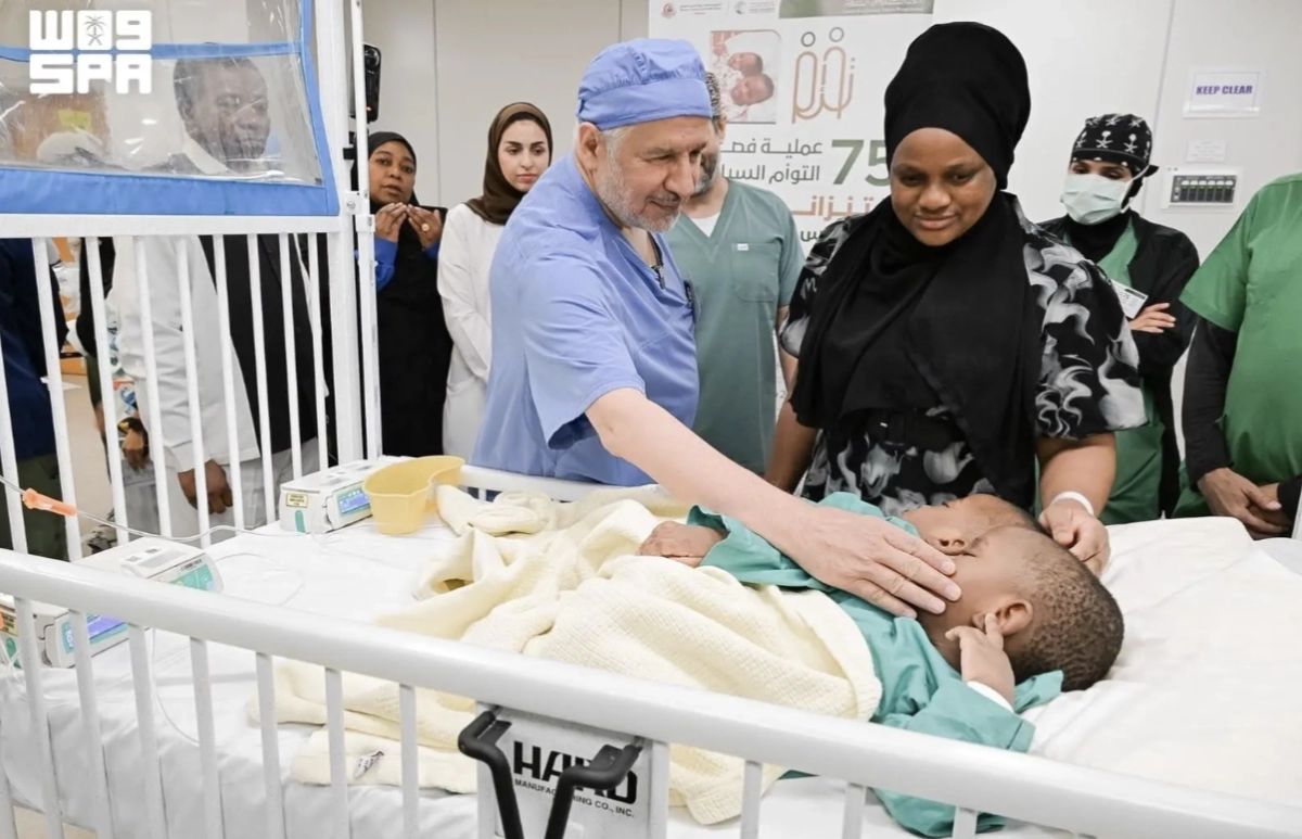 Saudi Arabia begins 15-hour operation to separate Tanzanian conjoined twins