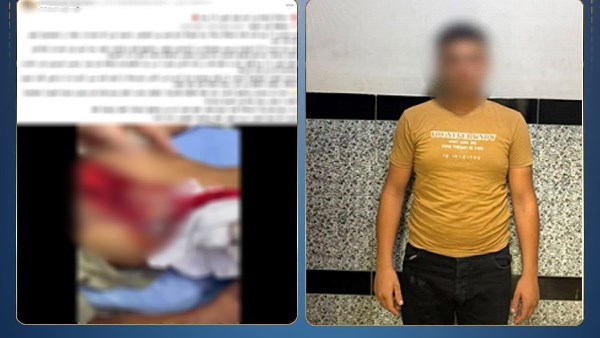 تعدى على طفلين بالضرب وأصاب أحدهما بقطعة زجاج.. وهذه عقوبة المتهم