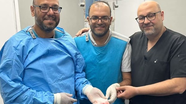 نجاح قسطرة مخية لعلاج انسداد الشريان القاعدي وإنقاذ مريض خلال 30 دقيقة