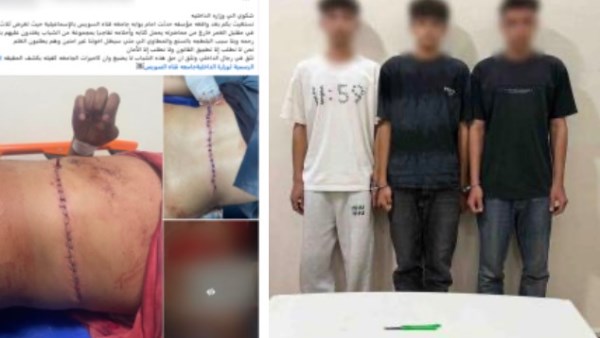 خلاف على أولوية ركوب سيارة.. ضبط المتهمين بالإعتداء على 3 طلاب بأسلحة بيضاء بالإسماعيلية