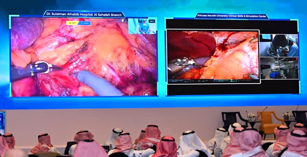 نقل مباشر لعملية استئصال جزئي للكلية بالجراح الآلي 
من مستشفى الدكتور سليمان الحبيب بالصحافة