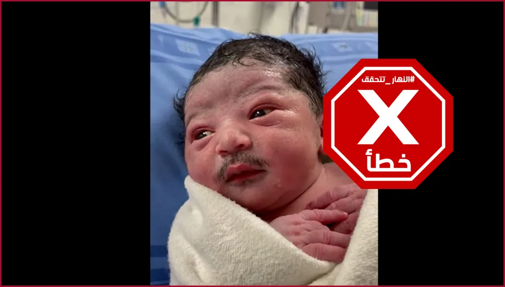 الأكثر تداولاً الآن… رضيع وُلِد بشارب؟ النهار تتحقق FactCheck