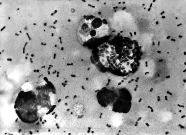 What is pneumonic plague and how dangerous is it?